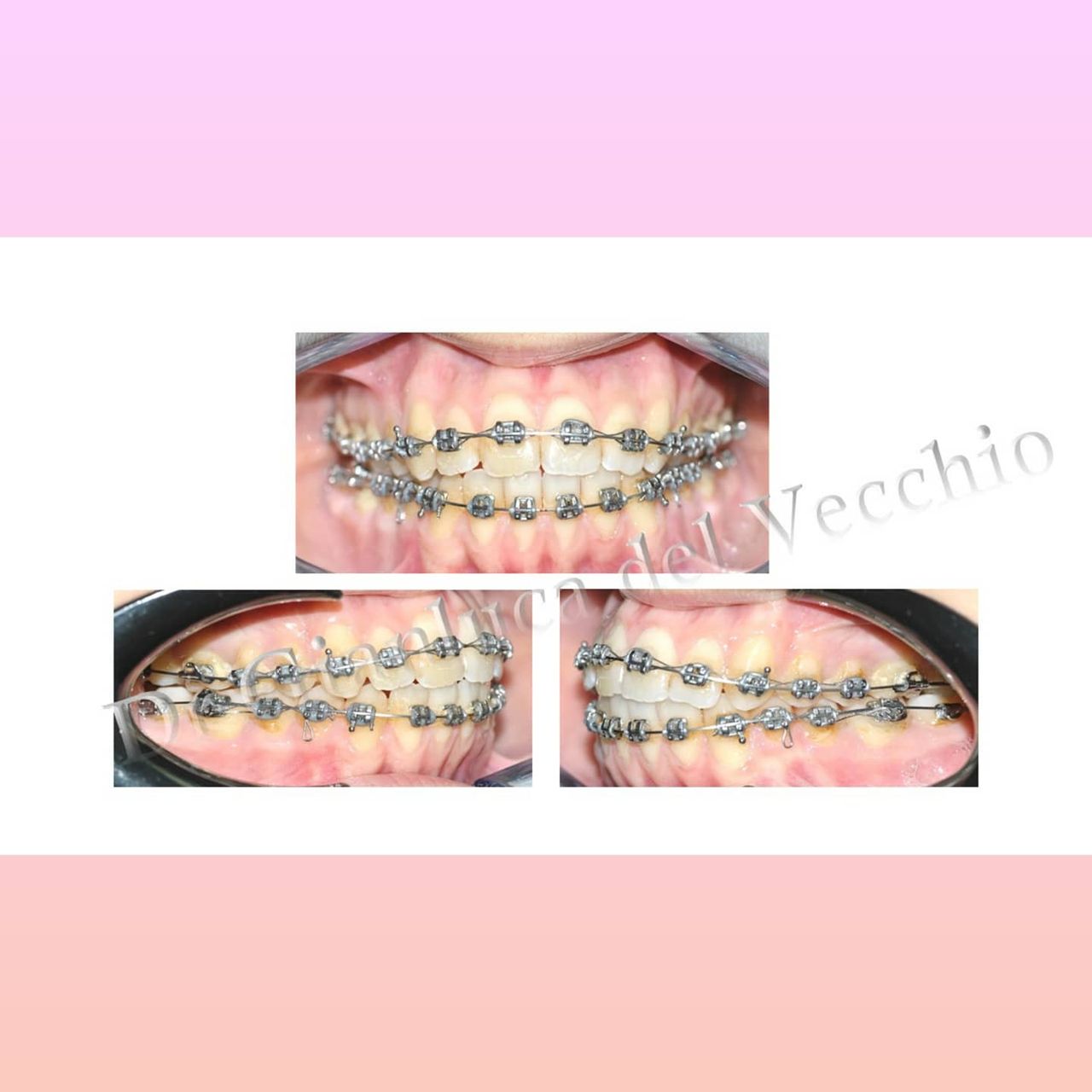 Gianluca Del Vecchio-64