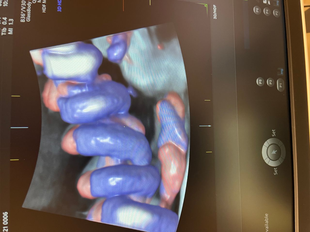 Katarzyna Leszczyńska-18