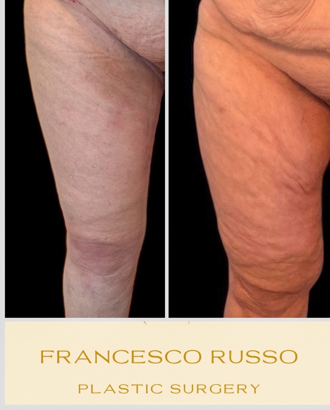 Francesco Russo-19