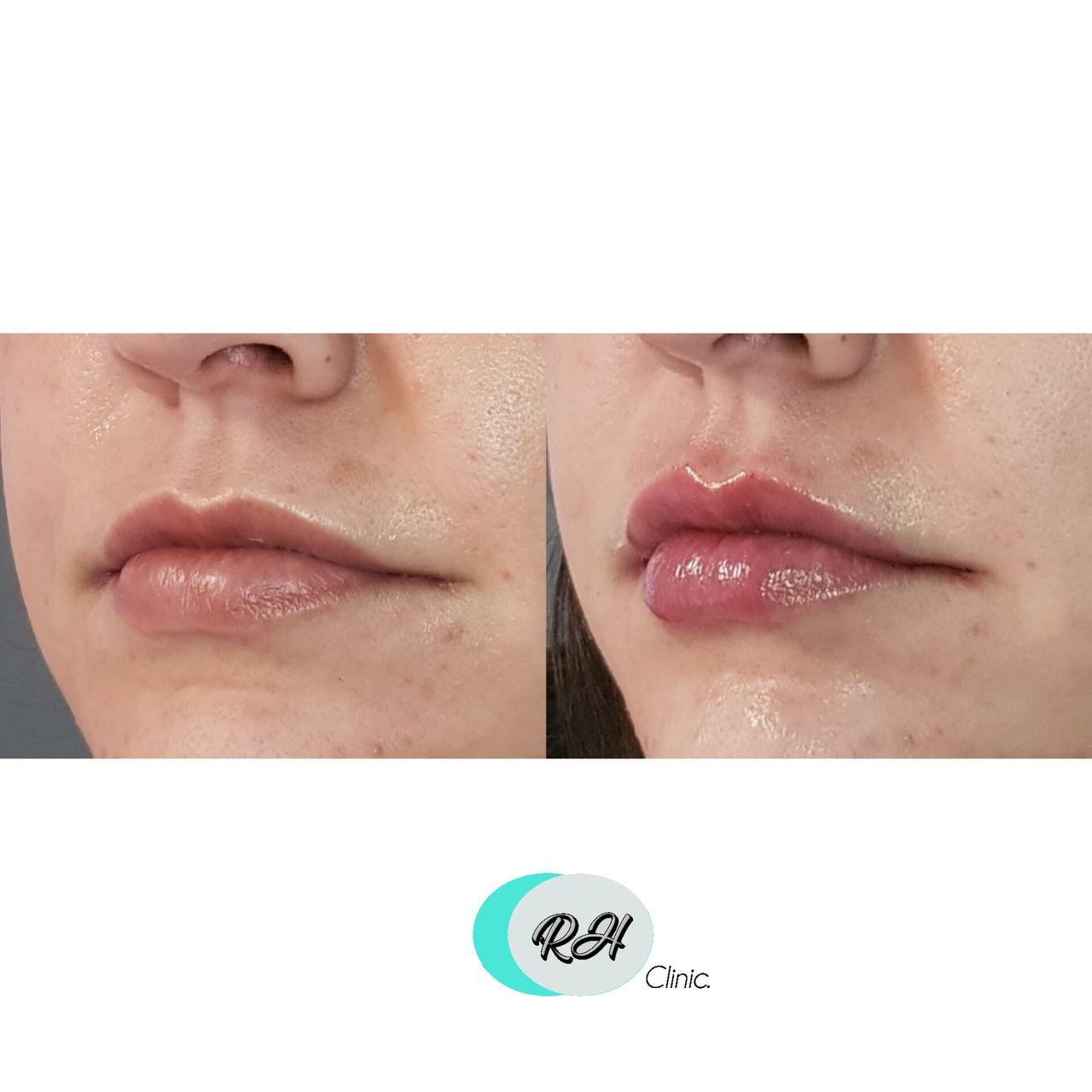 Rosalba Herrero Zerpa-113