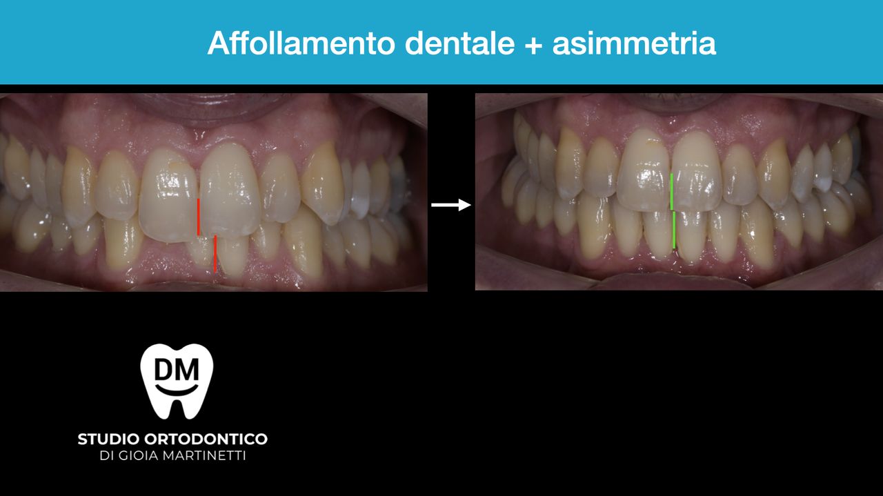 Francesco Martinetti-2