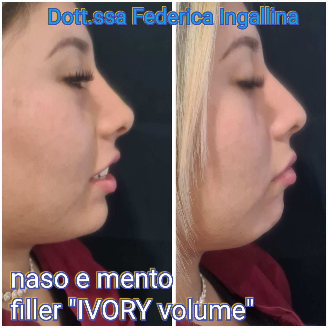 Federica Ingallina-24