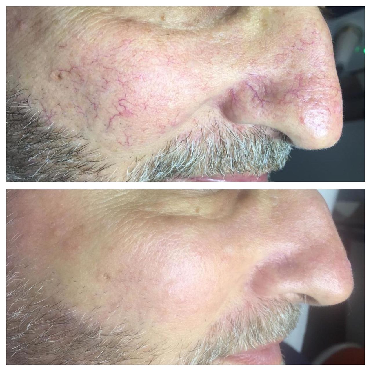 Bernardo Bottalico-4