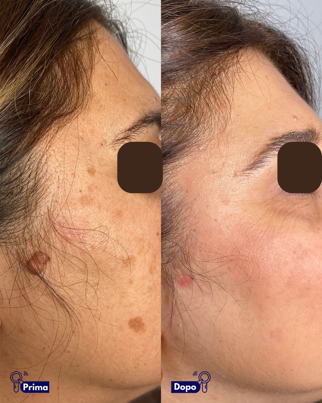 Alfredo Piccerillo-8