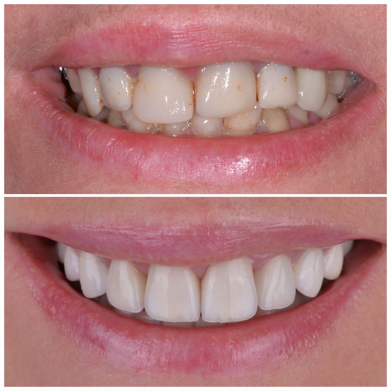 Martin Bartoszcze-20