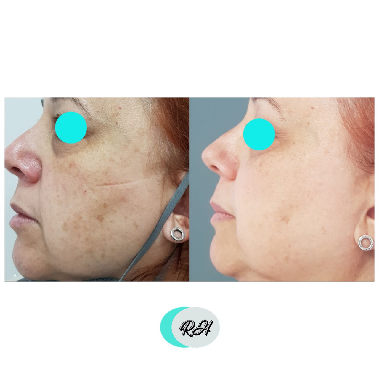 Rosalba Herrero Zerpa-184