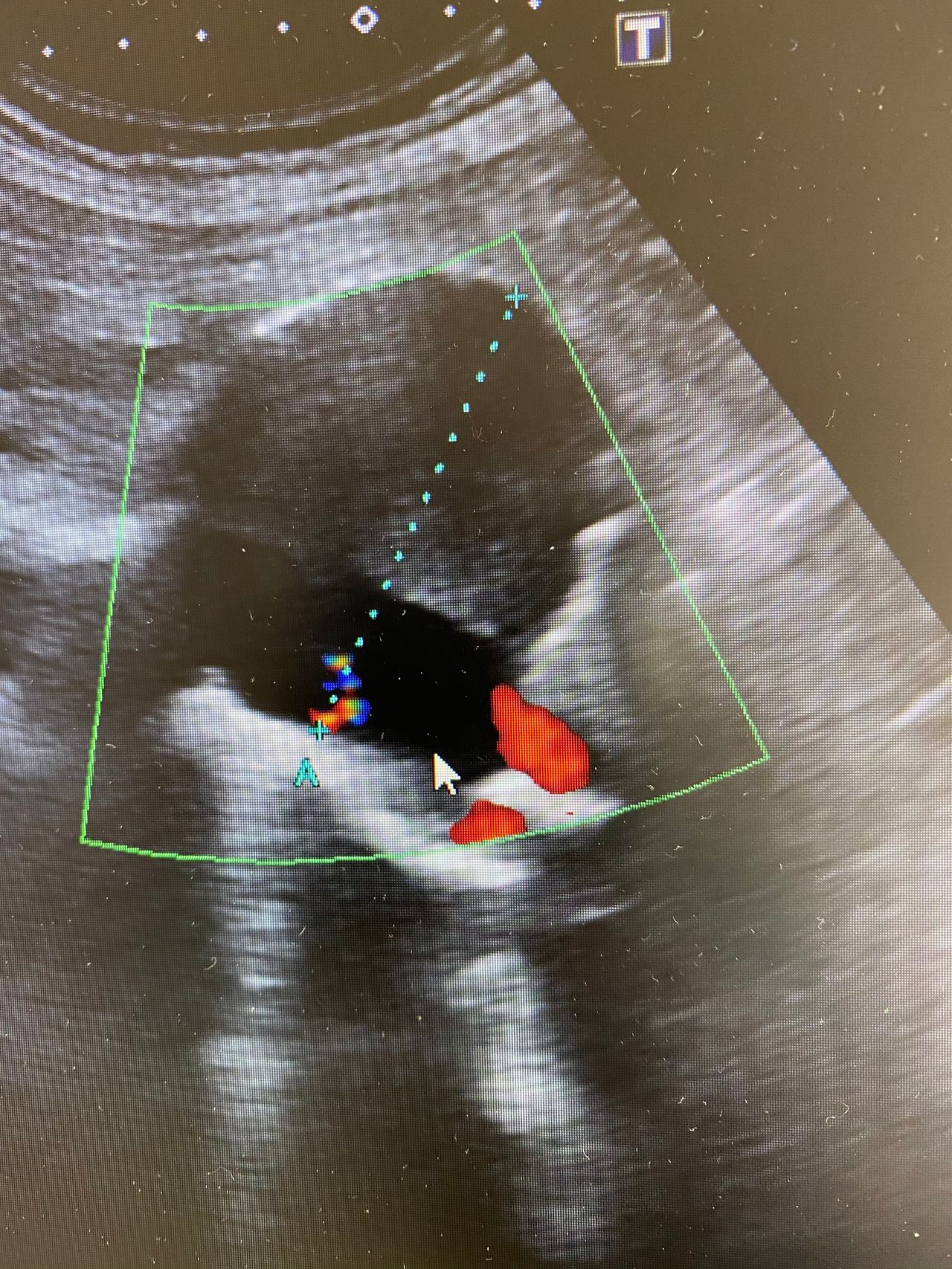 Giovanni Mastrangelo-0