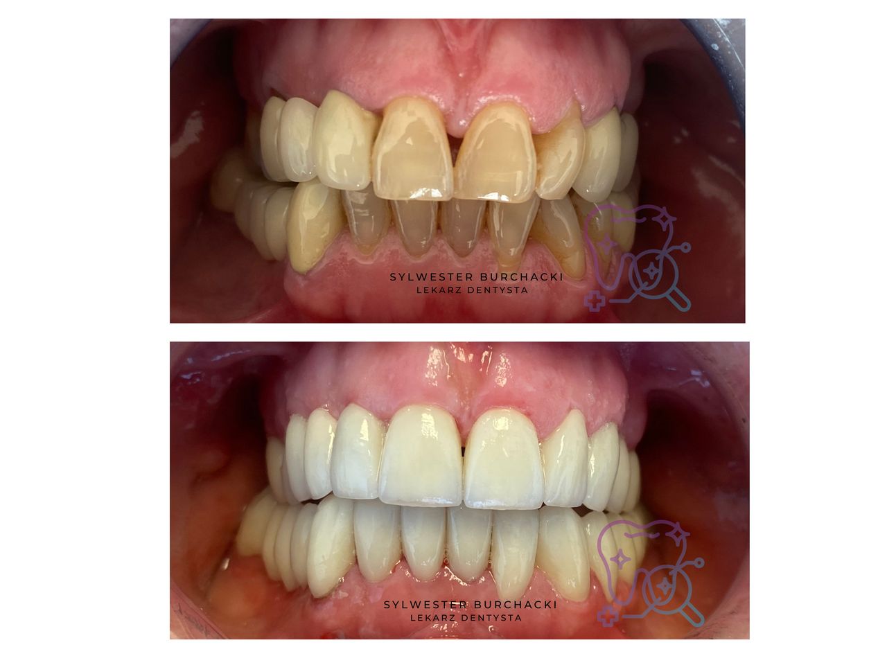 Sylwester Burchacki-1
