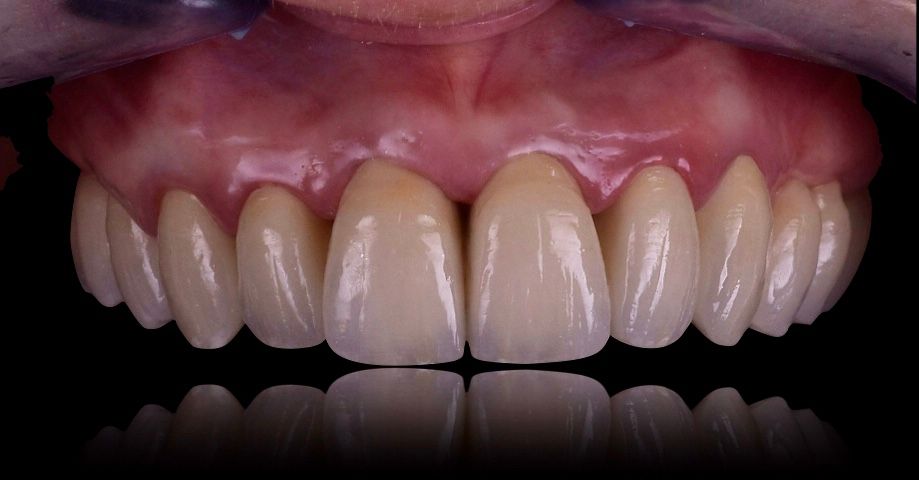 Riccardo Giardina-35