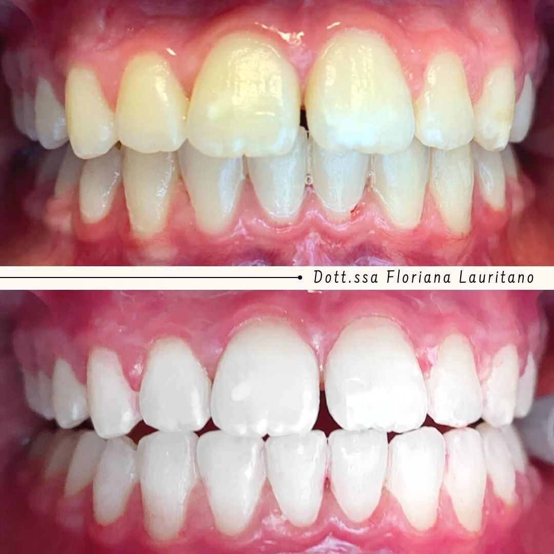 Floriana Lauritano-19