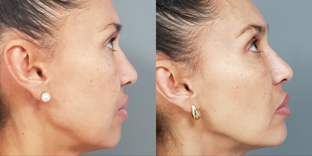 Rosalba Herrero Zerpa-480