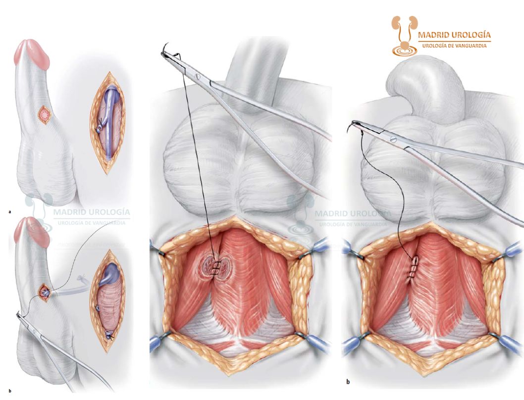 Luis Fernando Susaníbar Napurí-31