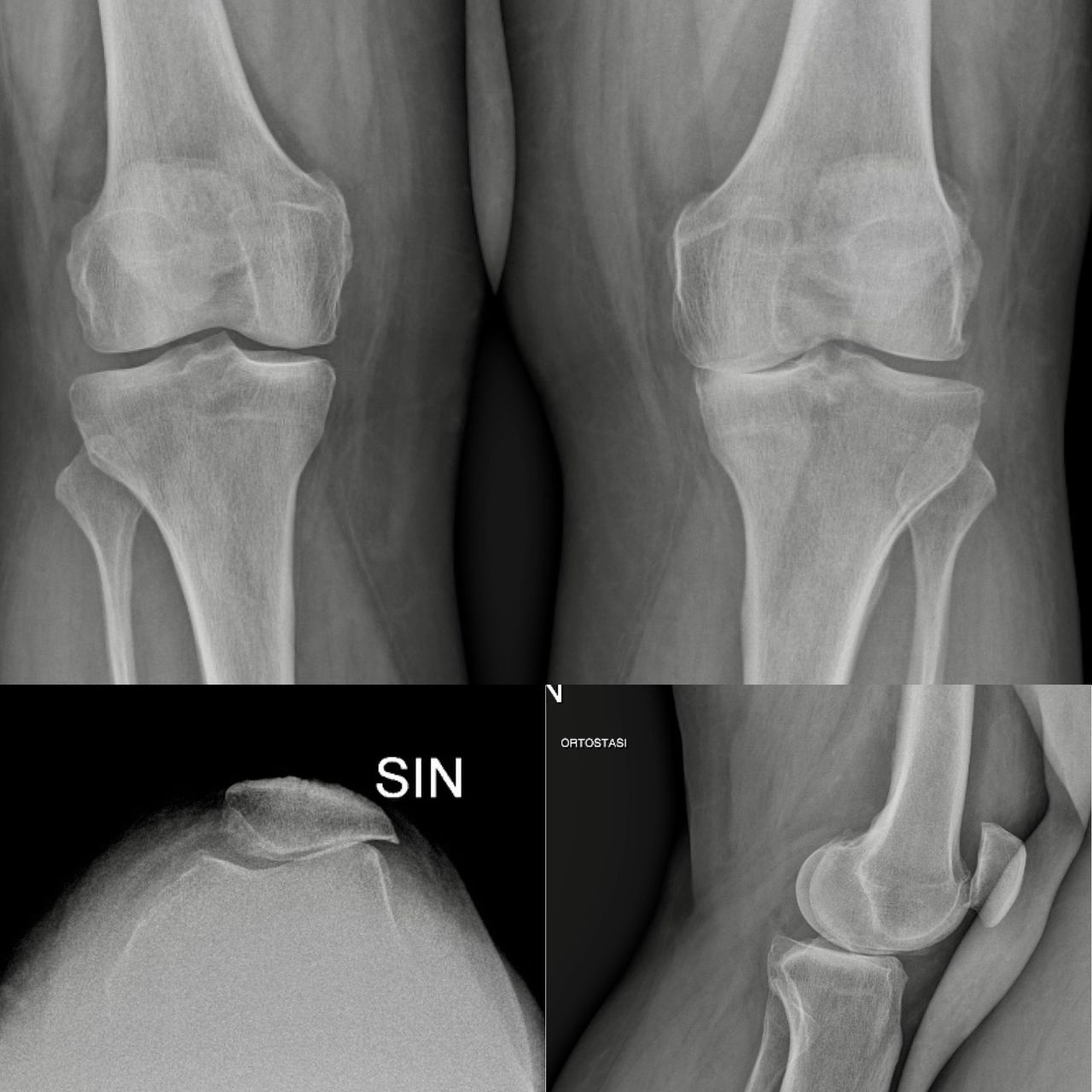 Marco Bargagliotti-6