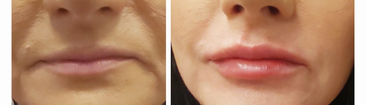 Małgorzata Pożarkowska-Kozik-22