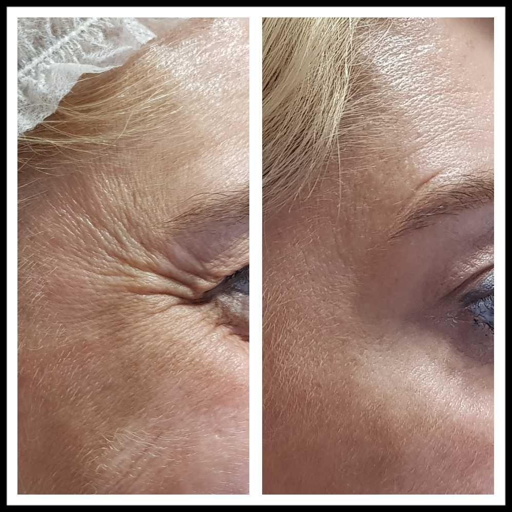 Rosalba Herrero Zerpa-382