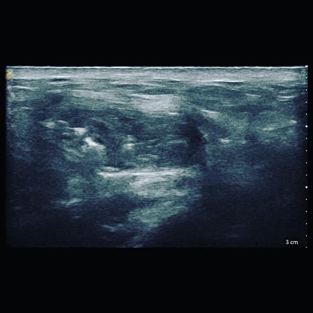 Jacopo Pettinelli-11