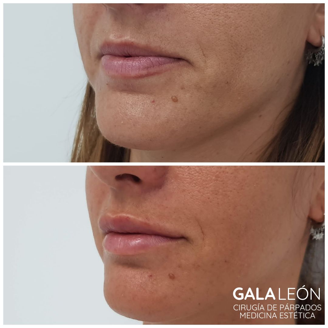 Gala P. Leon Salvatierra-8