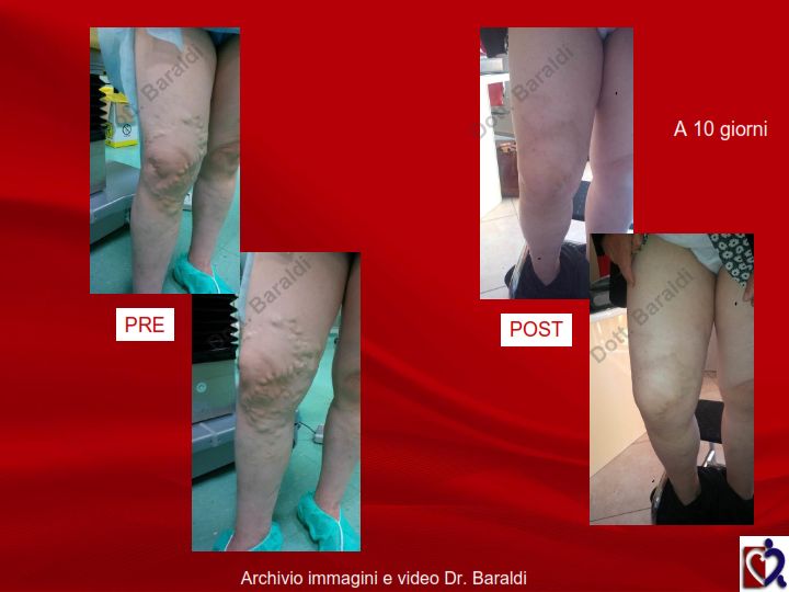 Christian Baraldi-10