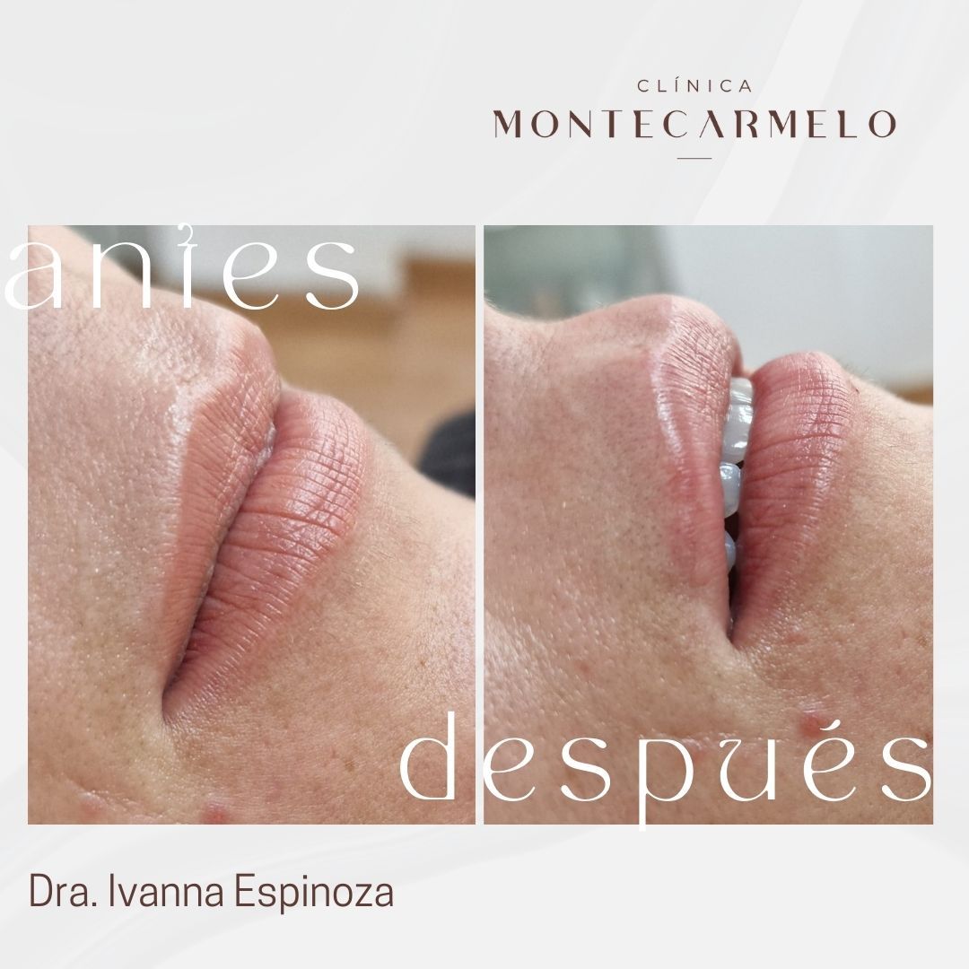 Carmen Martin Marcos-7