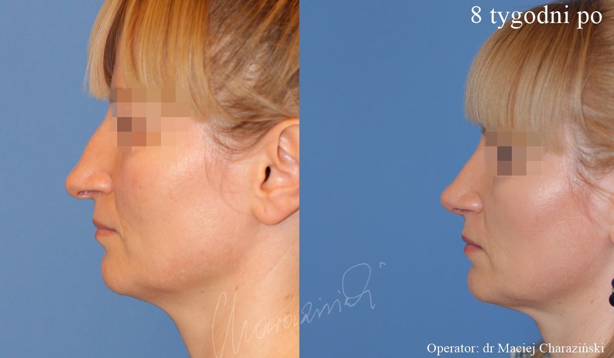 Maciej Charaziński-28