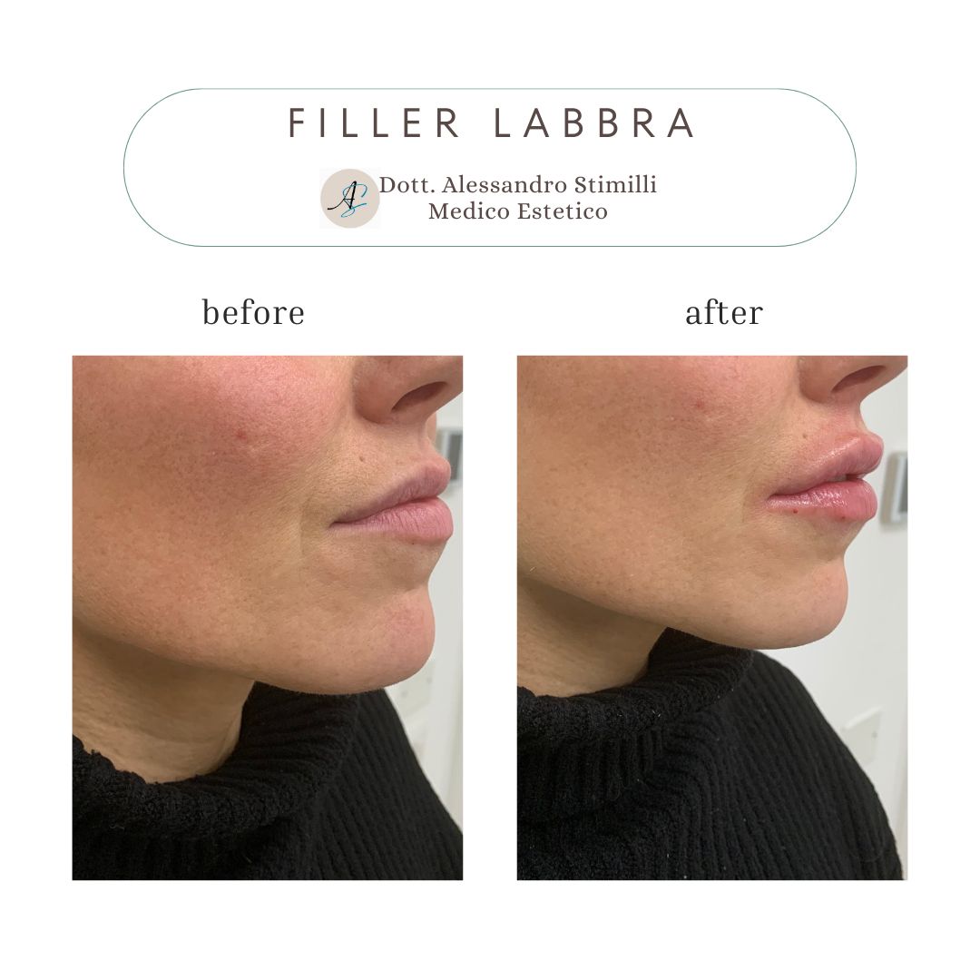 Alessandro Stimilli-20