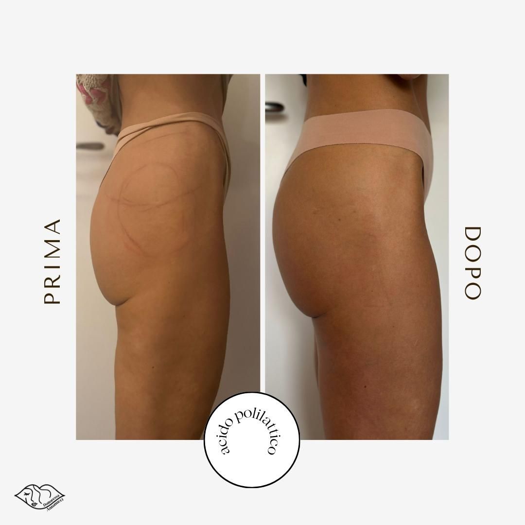 Maria Giordana Antonucci-24