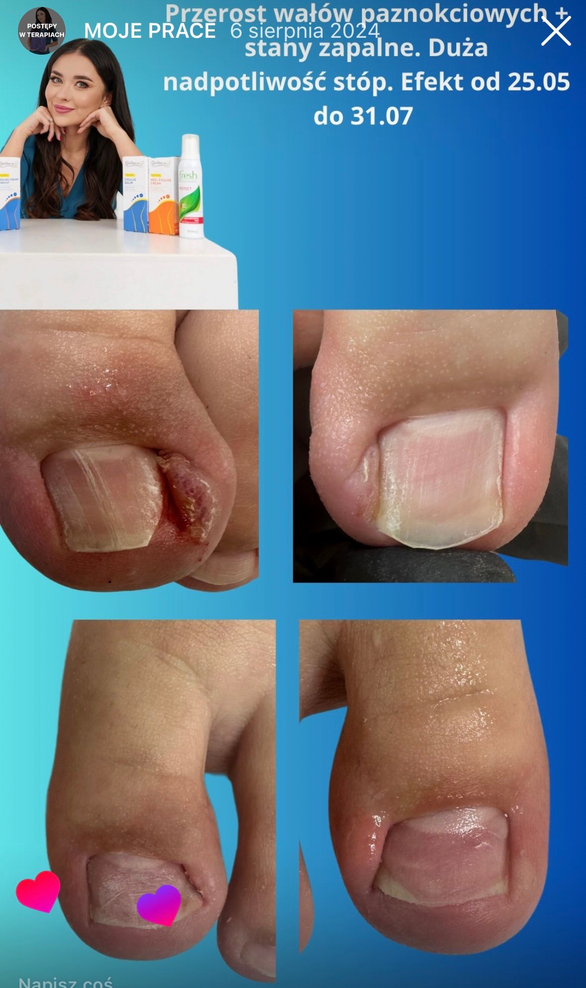 Karolina Colonna-Walewska-9