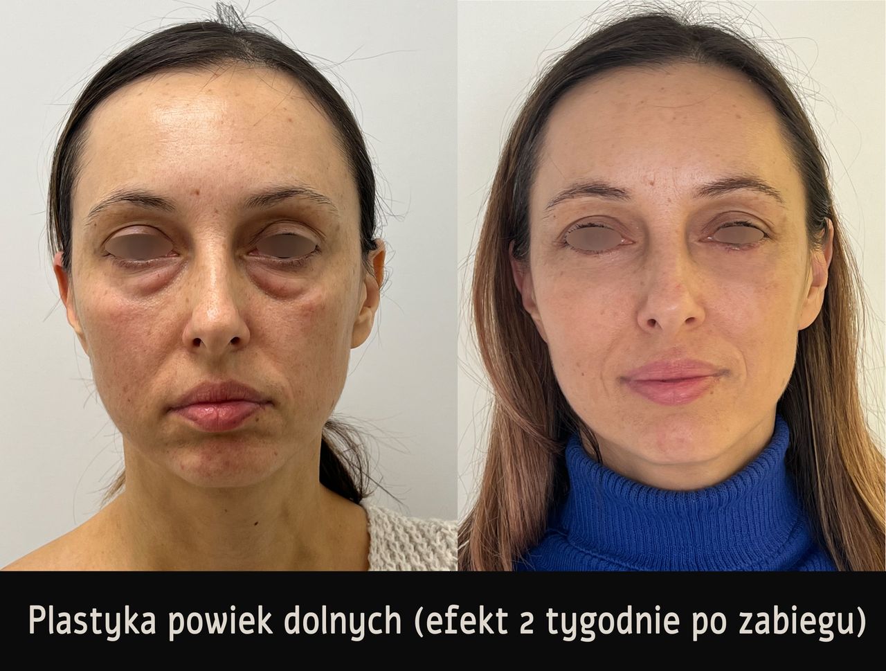 Mariusz Zagajewski-9