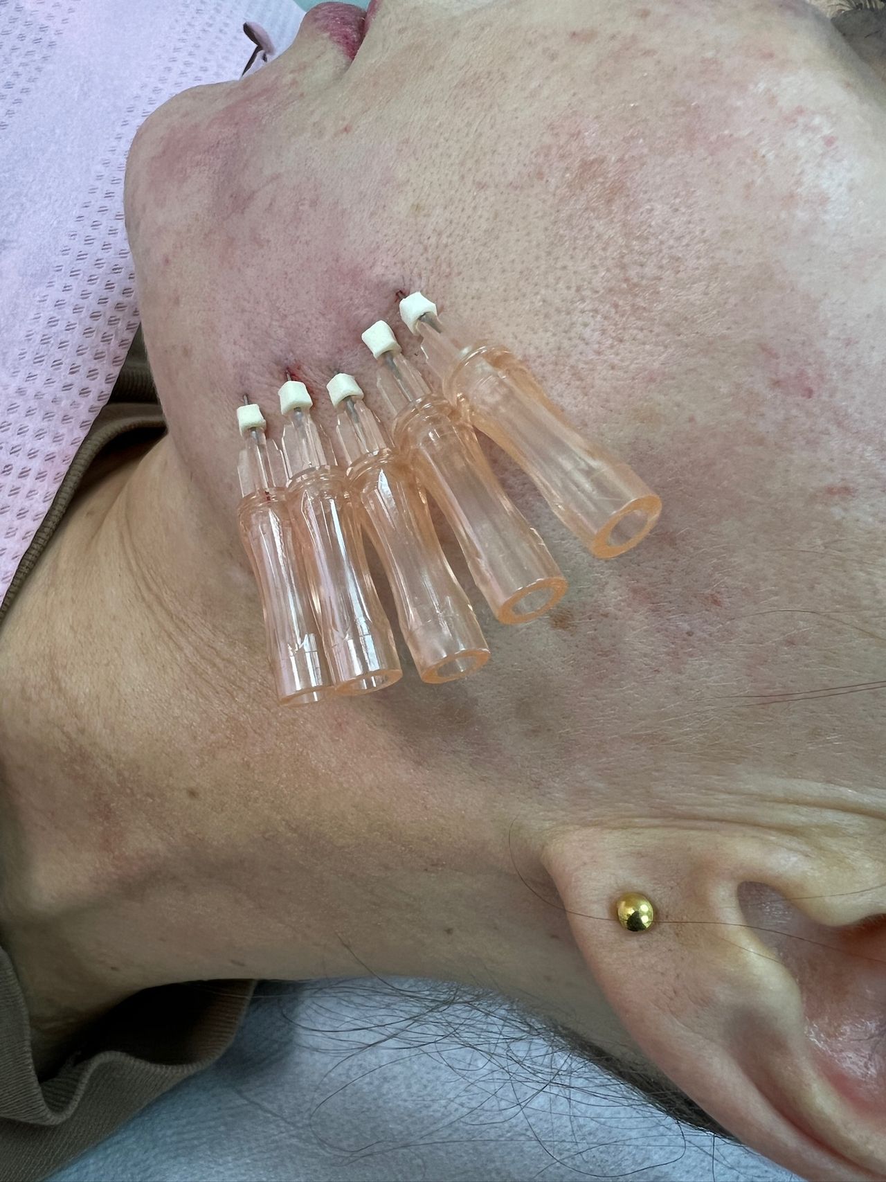 Aleksandra  Plata-Babula-12