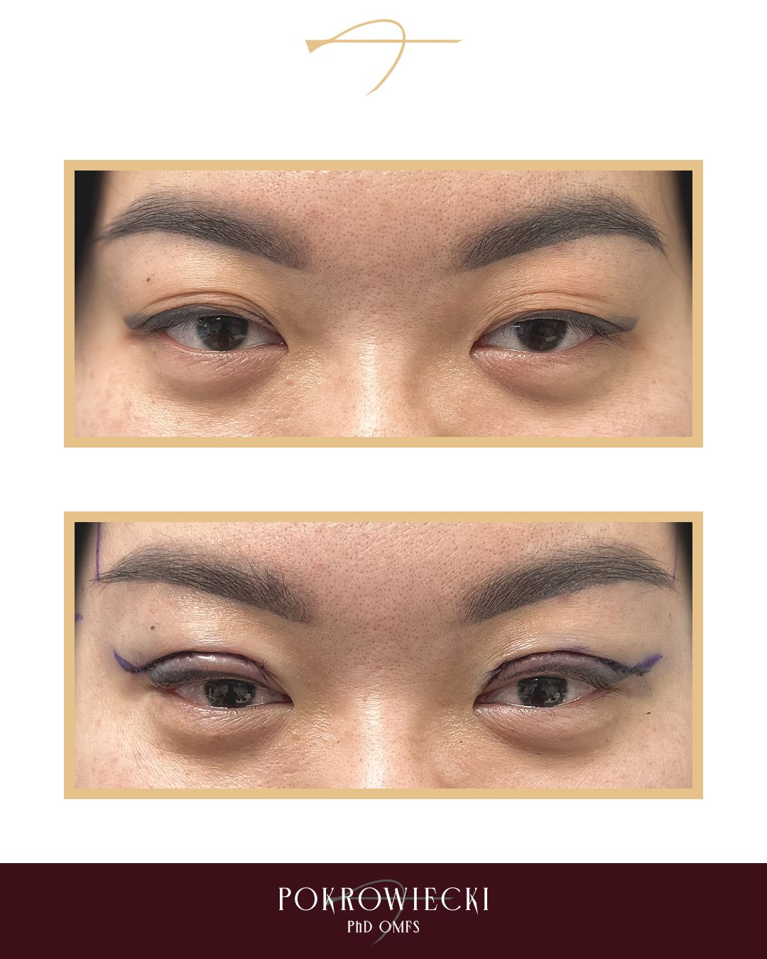 Rafał Pokrowiecki-11