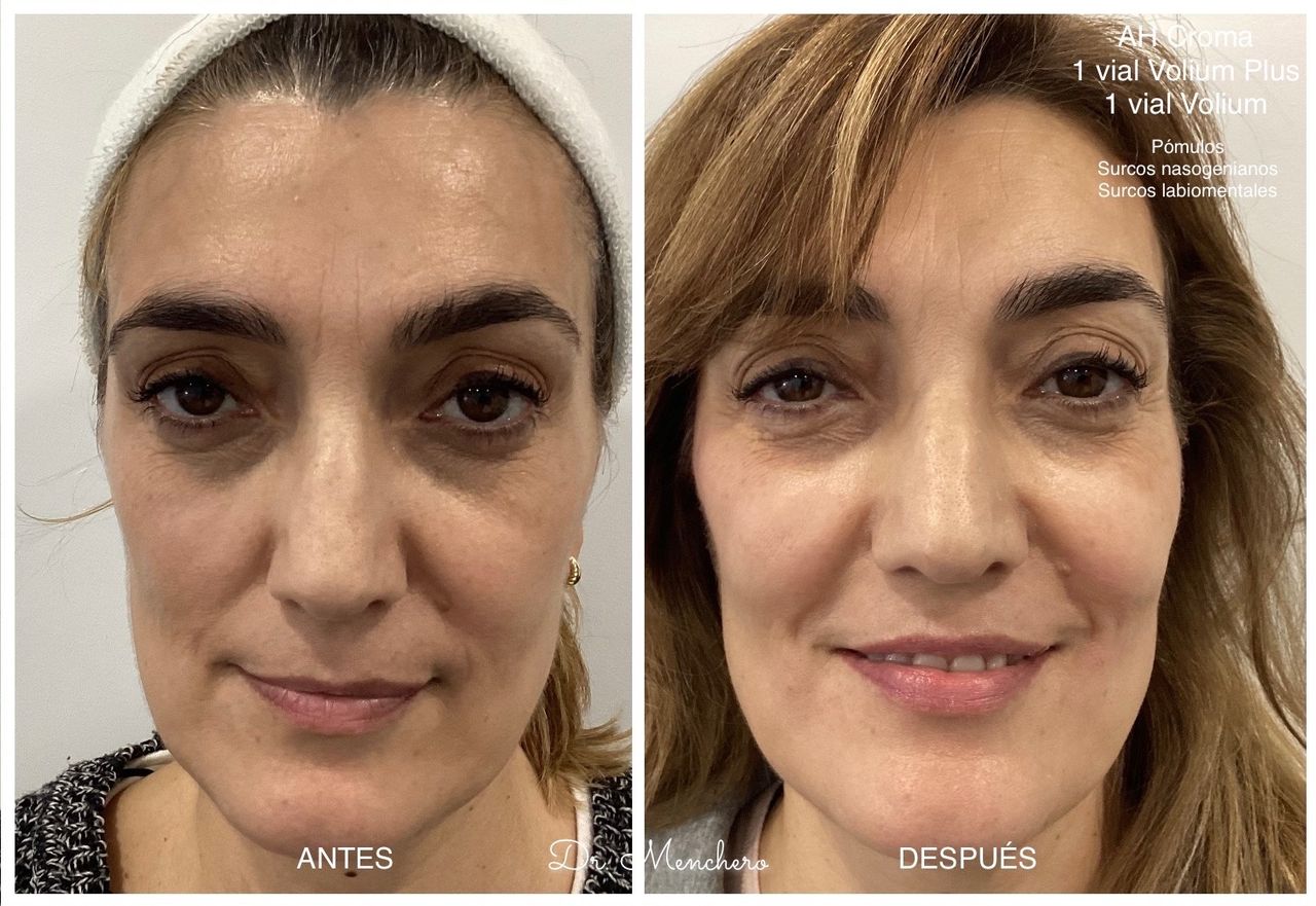 Arsenio Menchero Sánchez-12