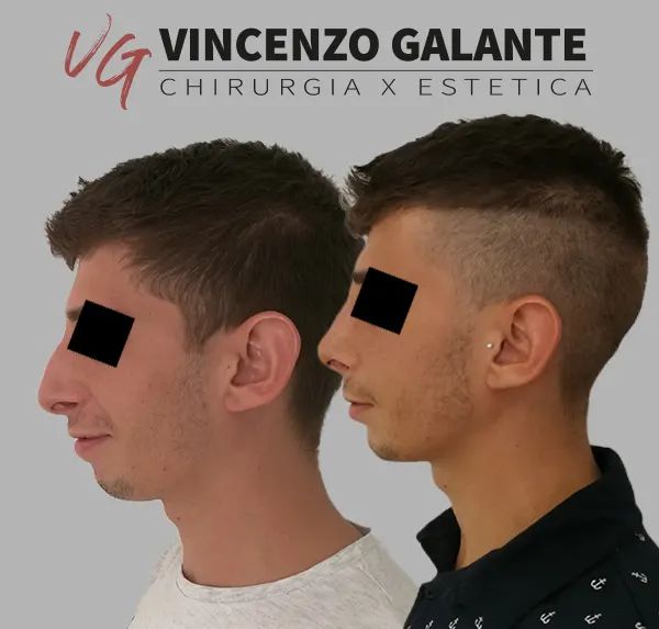 Vincenzo Galante-3
