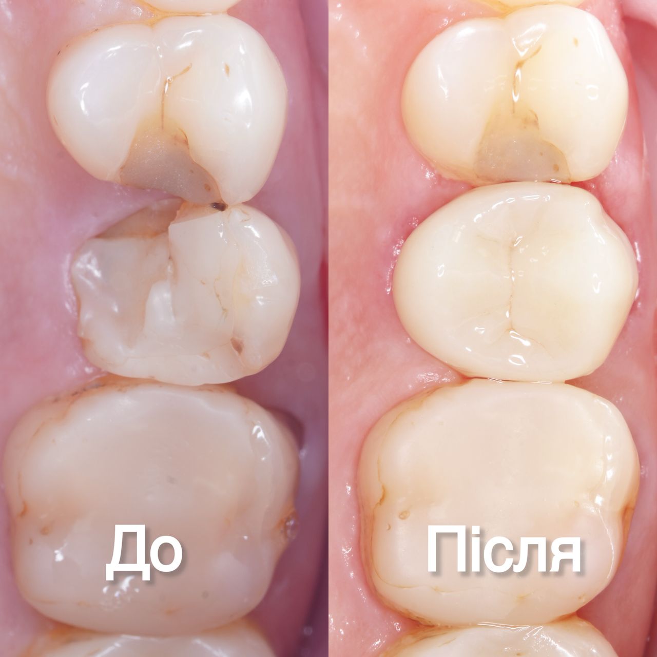 Vadym Dytiuk-7