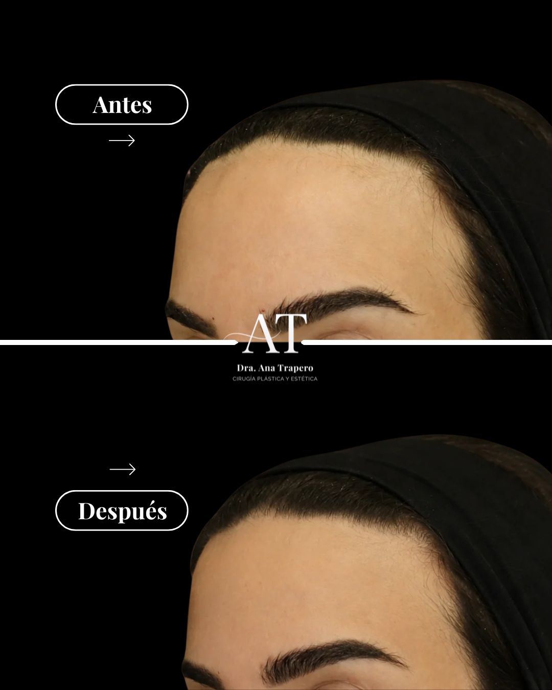 Ana Trapero-5