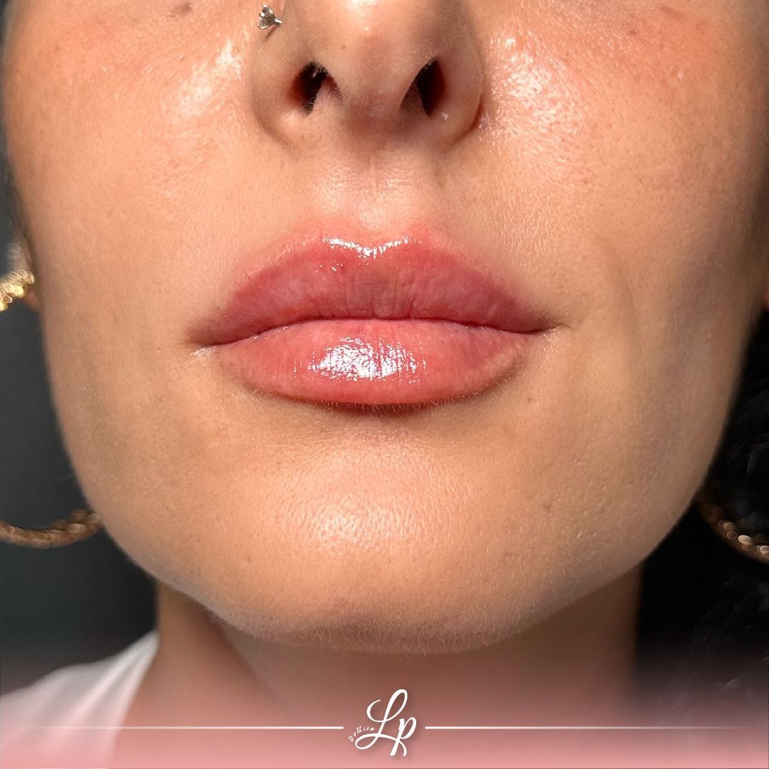 Ludovica Pollifrone-12