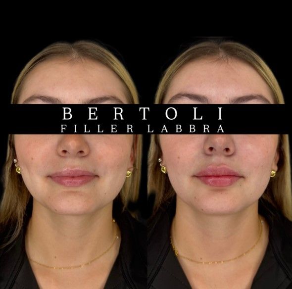 Andrea Bertoli-24