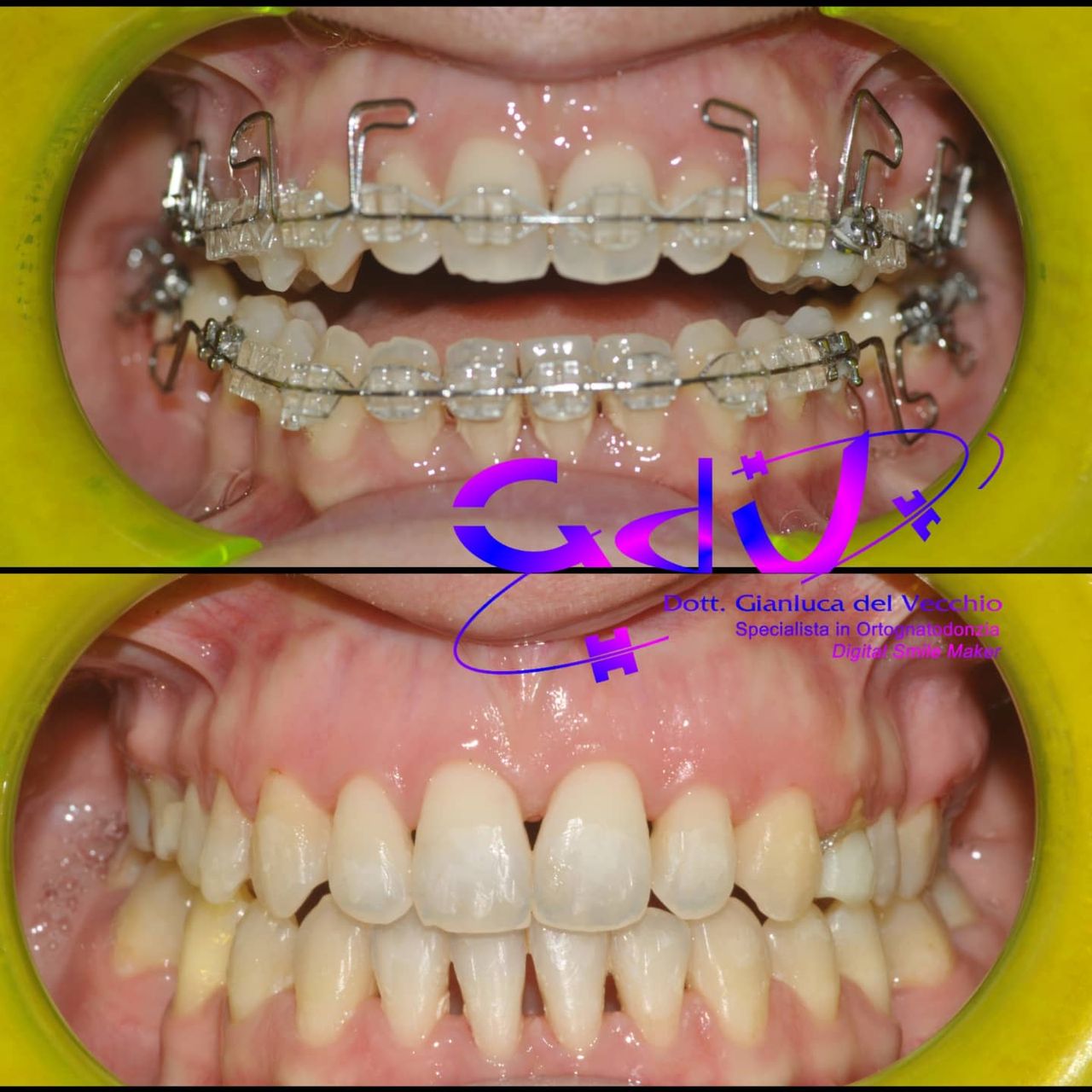 Gianluca Del Vecchio-124