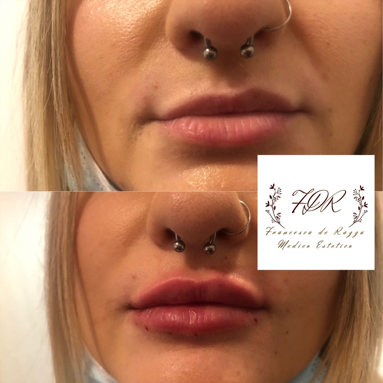 Francesca De Razza-57