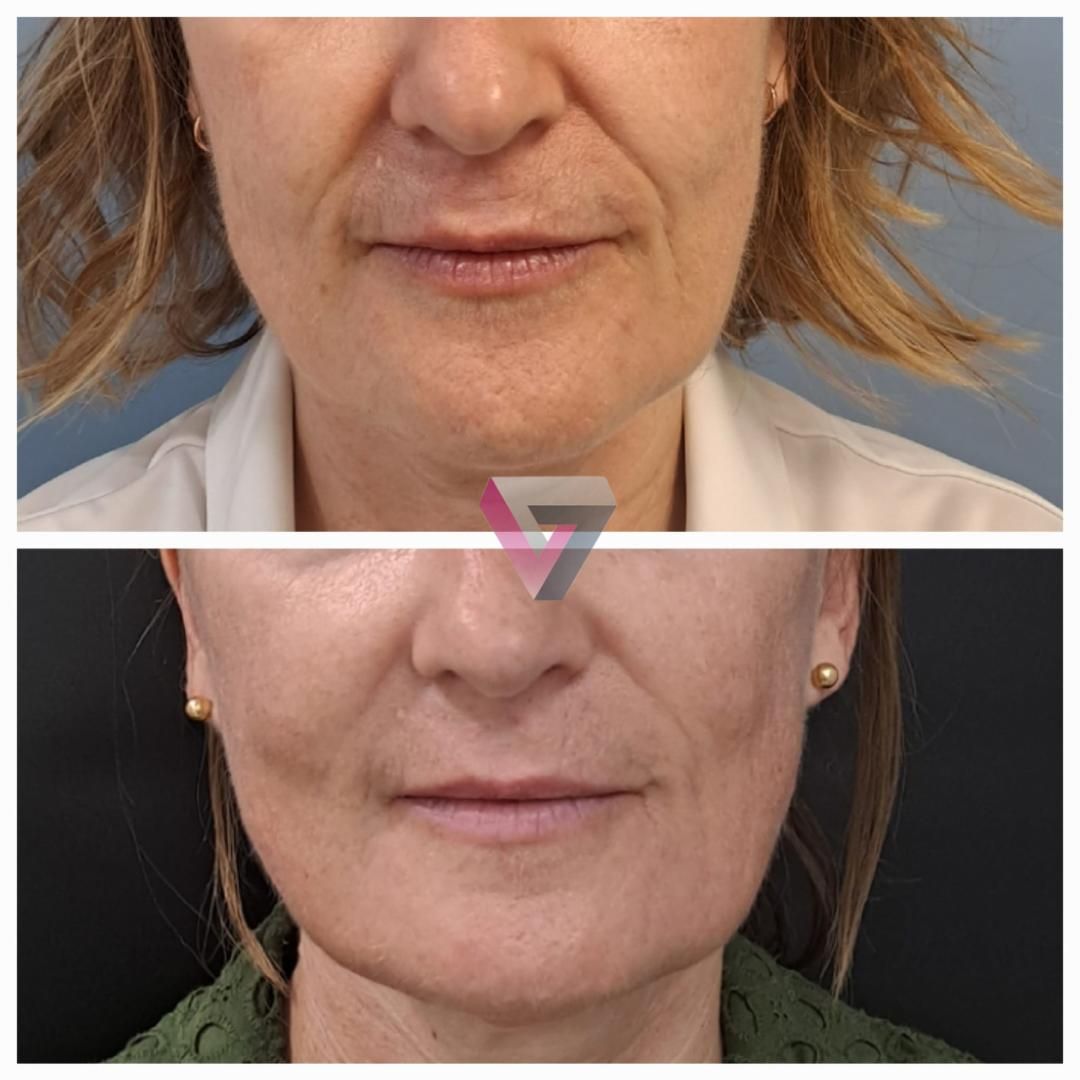 Victoria Trasmonte-86