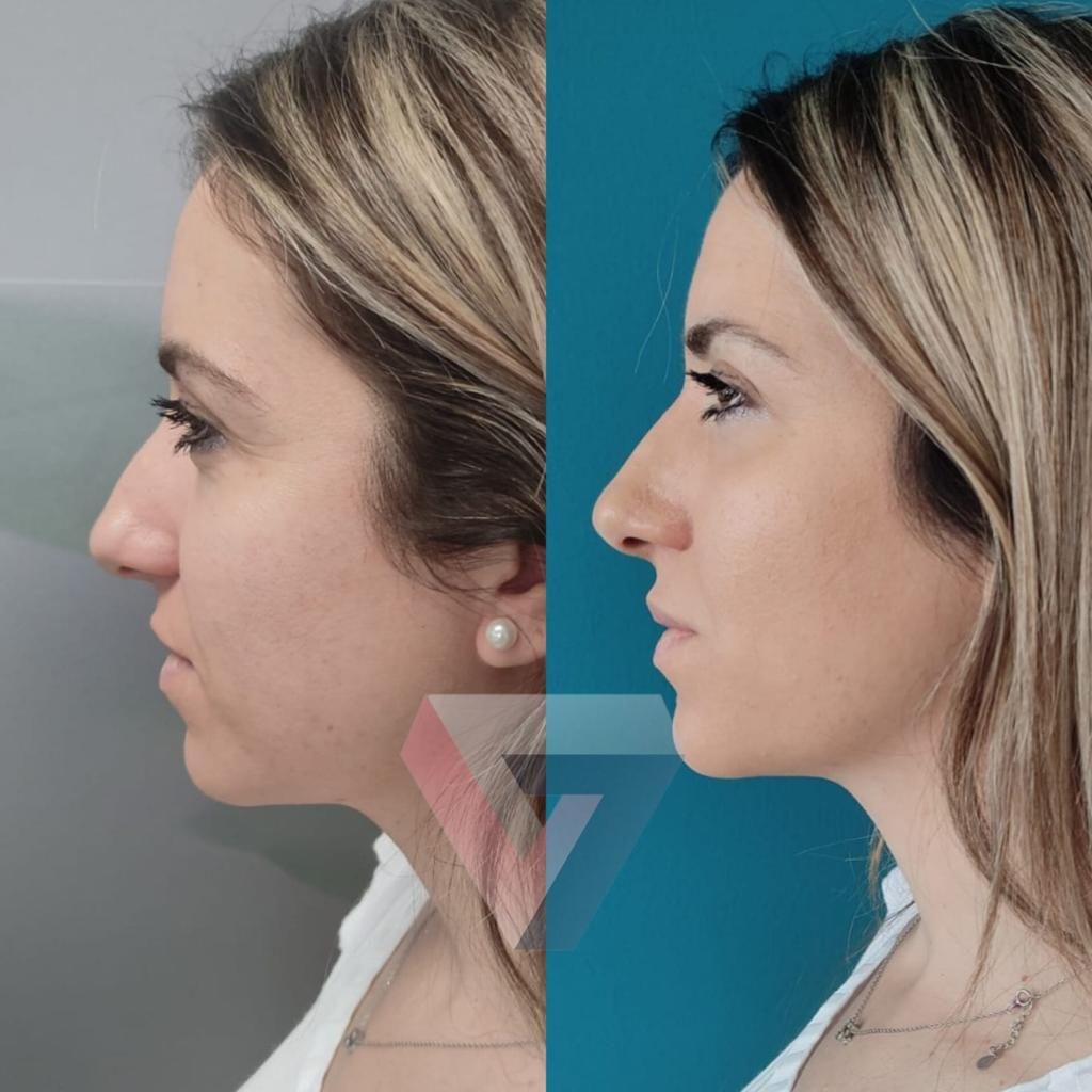 Victoria Trasmonte-54