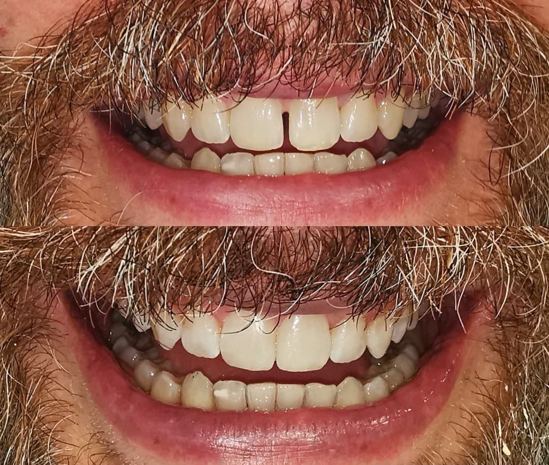 Alba Araujo Alvarez-5