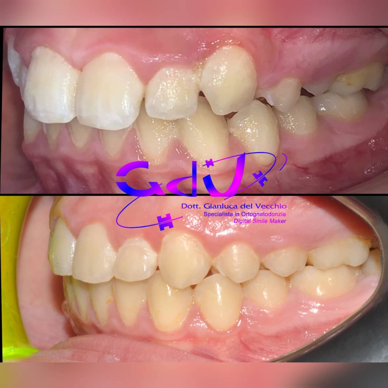 Gianluca Del Vecchio-121