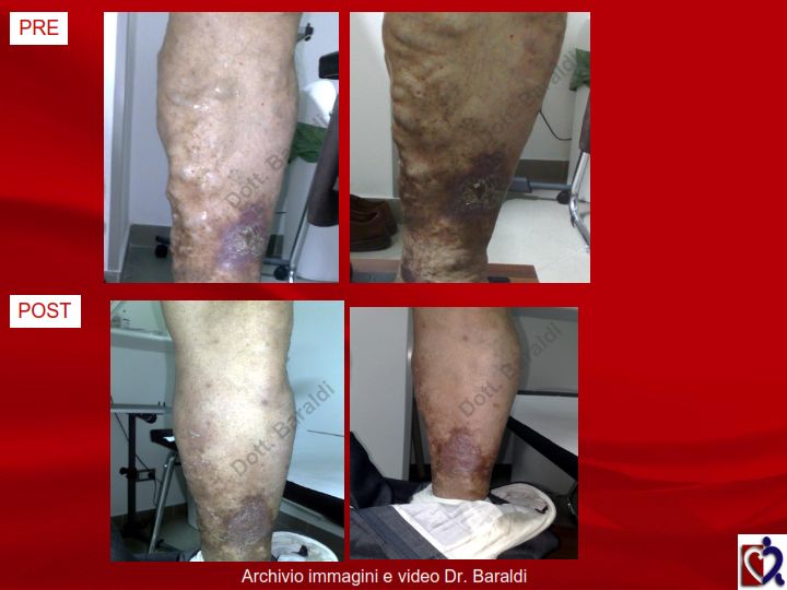 Christian Baraldi-14