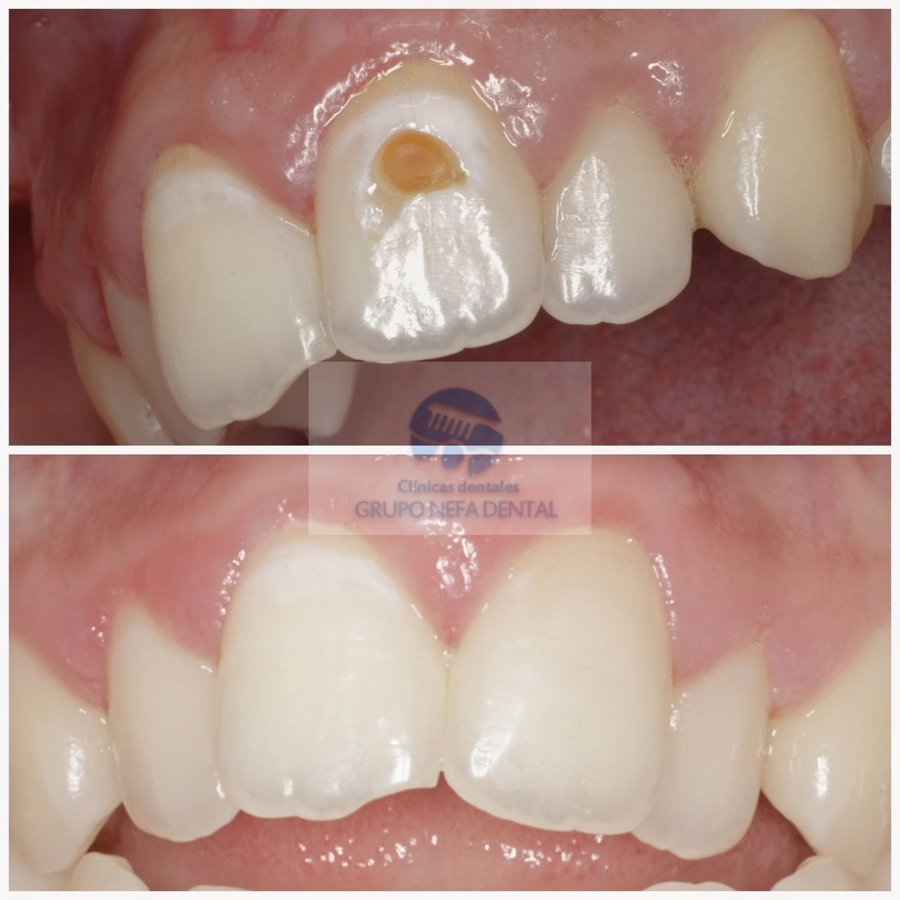 Gustavo Nefa Gaillez-8