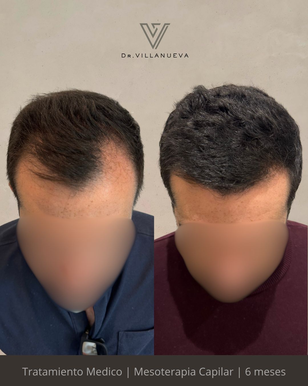 Alfredo Villanueva-10