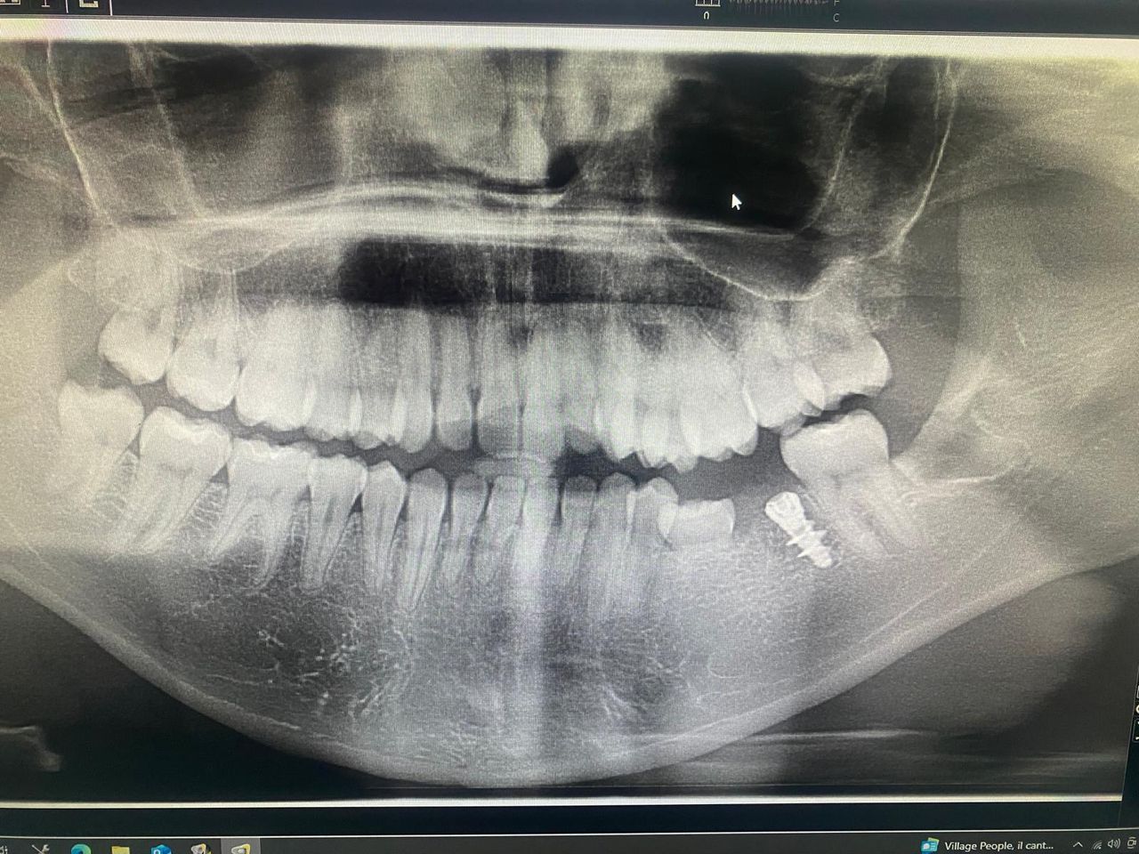 Luigi Giuseppe Romano-20