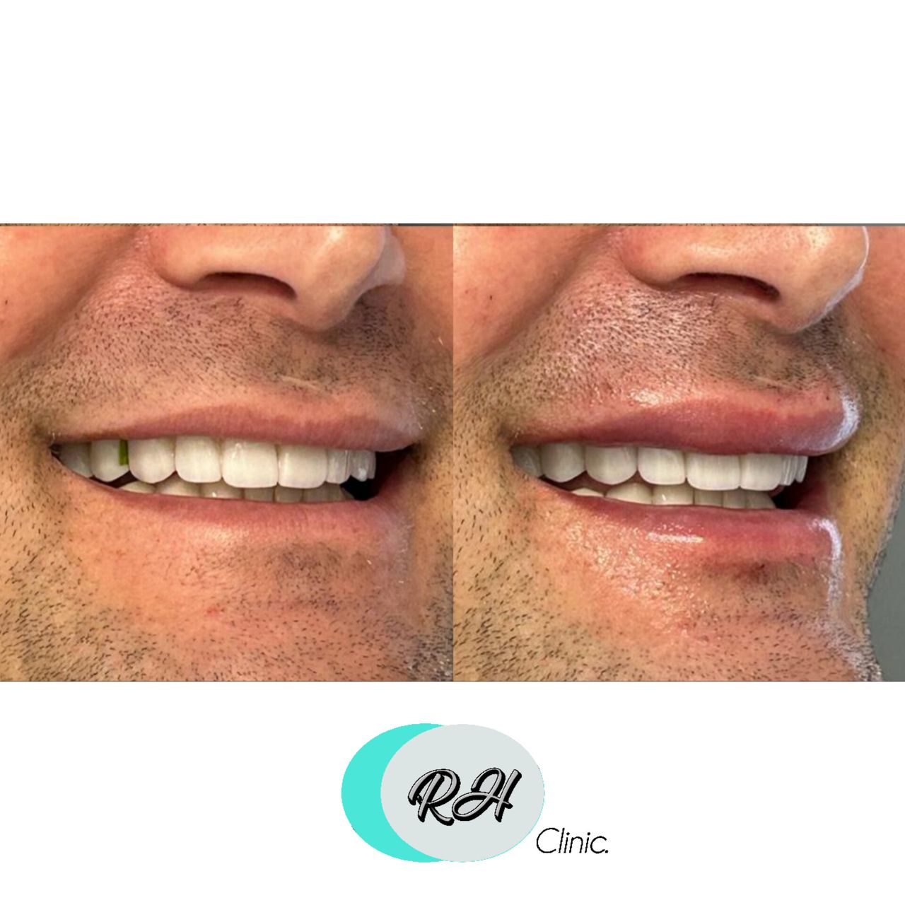 Rosalba Herrero Zerpa-107