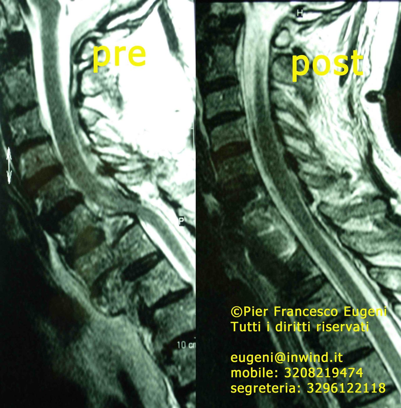 Pier Francesco Eugeni-6