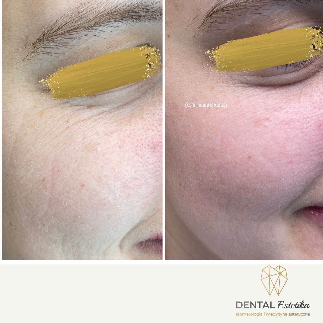 Angelika Świątkowska-25