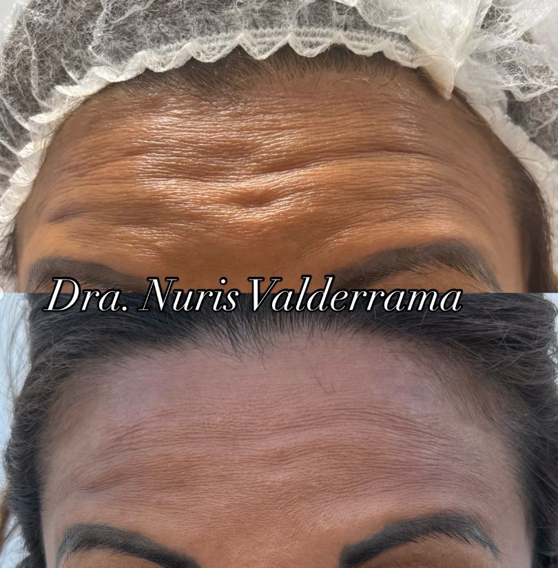 Nuris Dariela Valderrama Villanueva-2